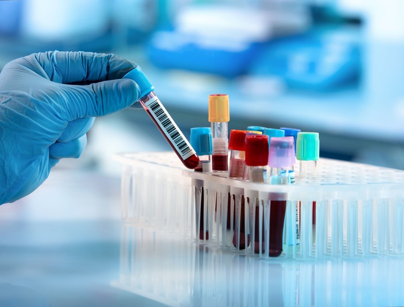 sclerosis multiplex antitest vér kutatás