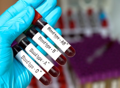 A világ egyik legritkább vércsoportját fedezték fel – mindössze három ember hordozza című cikk nyitóképe