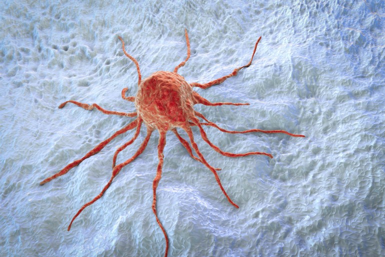 Kutatók összegyűjtötték azokat a jeleket, amelyek leggyakrabban utalhatnak a szervezetben rákra.