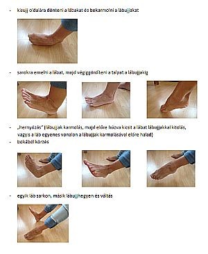 Gyógytornák: hogyan kezelhető a bütyök?