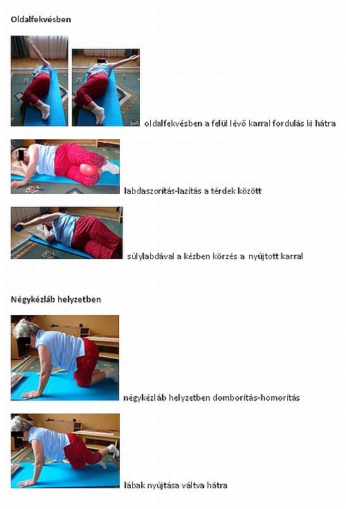 Parkinson-kór gyógytorna kezelése (2. rész)