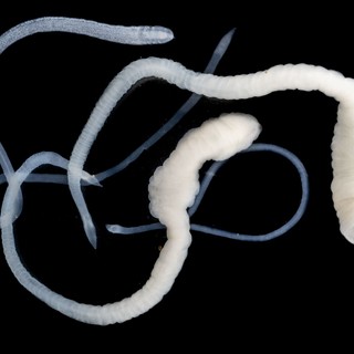 Ezek a tünetek jelezhetik azt, hogy galandféreg él a szervezetében című cikk nyitóképe