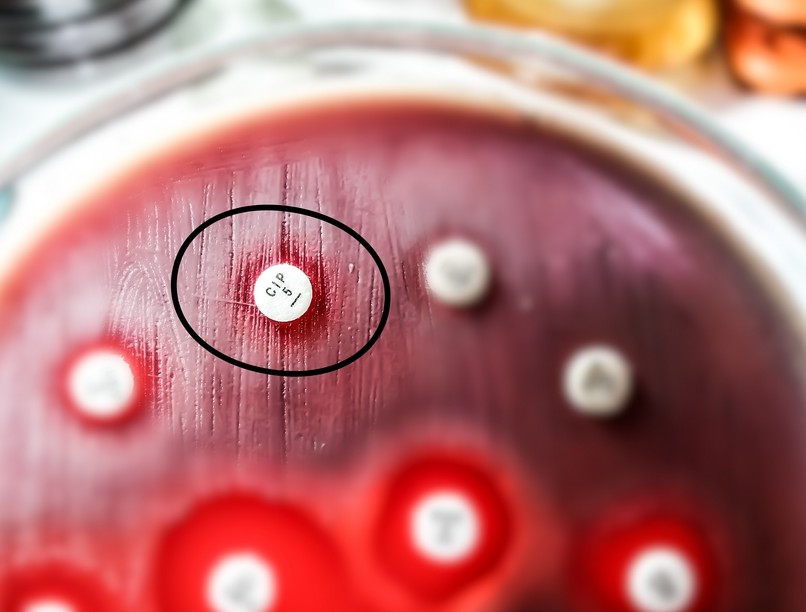 hatástalan antibiotikum baktériumok kezelése