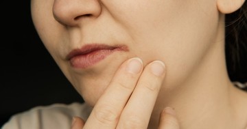 Berepedezett szájzug ellen ezek a leghatásosabb házi gyógymódok