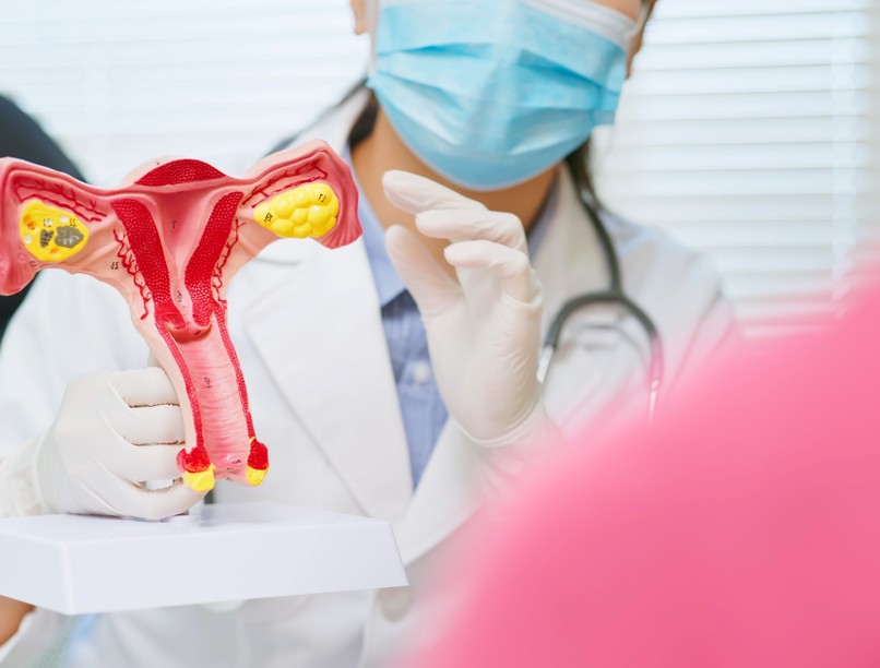 PCOS, fogamzásgátló, hormontermelés, túlsúly, cukorbetegség, ciszta, nőgyógyászat