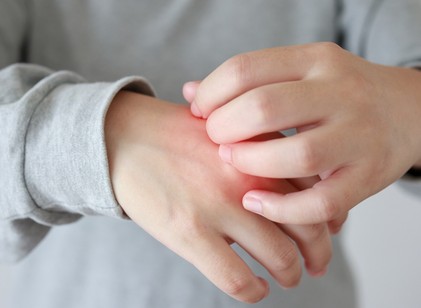 Miért viszket a bőröm télen? Ez áll a kellemetlen panasz hátterében című cikk nyitóképe