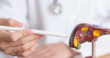 Májrák vagy májáttét? Az orvos elmagyarázza, mi a lényegi különbség