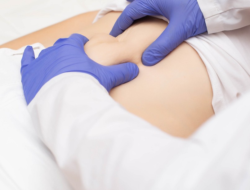 sérv, műtét, egynapos sebészet, menete