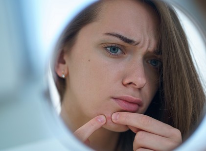 A bőrrák kezdeti tünetét sokan pattanásnak, apró sérülésnek nézik című cikk nyitóképe