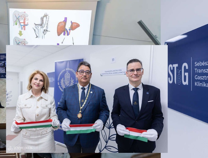 Megújultak Transzplantációs Májambulancia