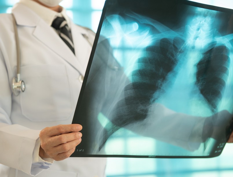 szúró mellkasi fájdalom levegővételkor