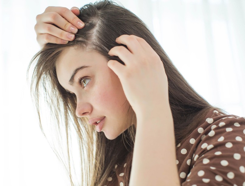 foltos hajhullás oka kezelése