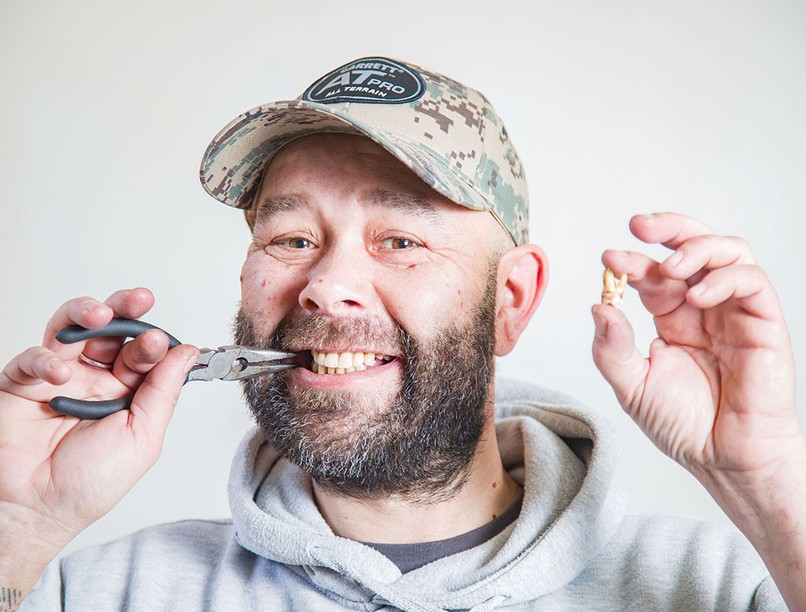 fogászat, foghúzás, fájdalom, időpont