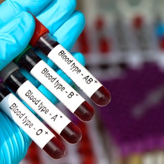 A világ egyik legritkább vércsoportját fedezték fel – mindössze három ember hordozza című cikk nyitóképe