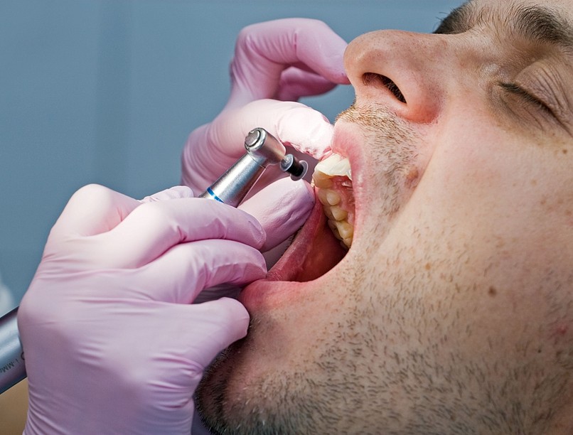 fáj foghúzás fog után hát  probléma