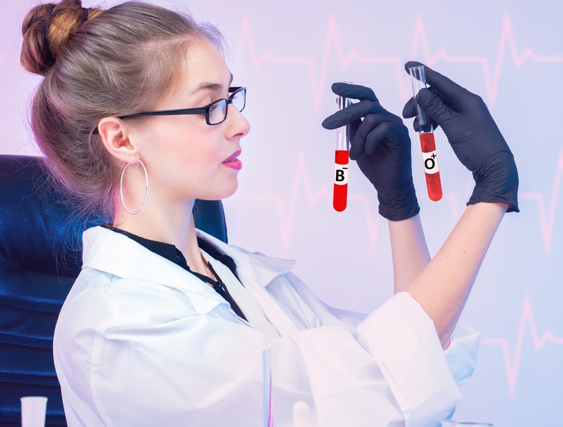 stroke, vércsoport, agyvérzés, fejfájás