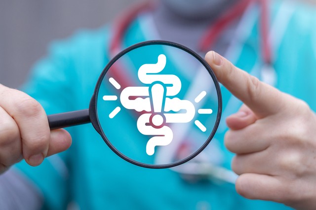 Mi a székletvizsgálat és mit mutat ki?