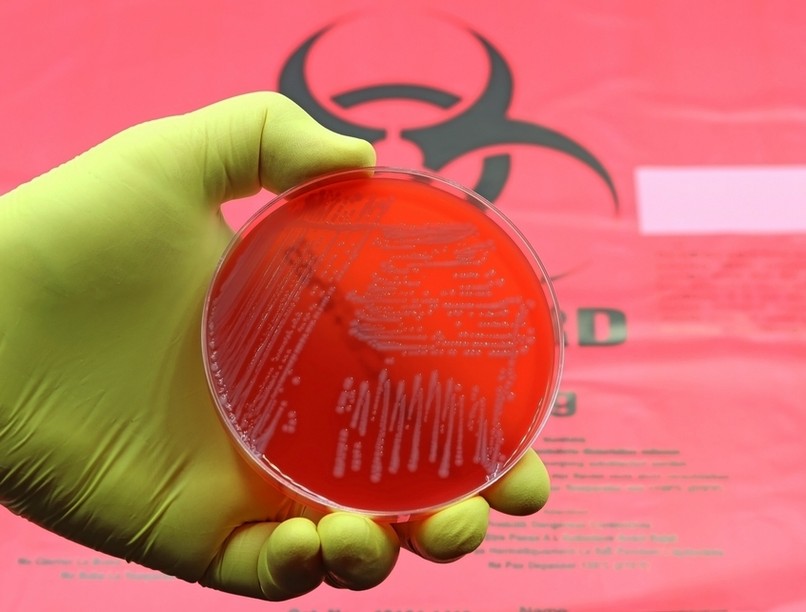 Acinetobacter baumannii antibiotikum rezisztencia AI