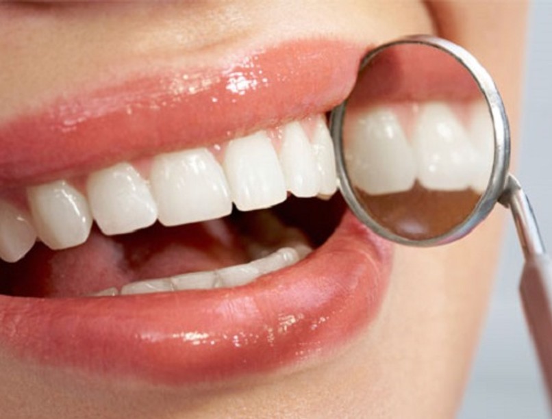 is-diy-teeth-whitening-good-for-you-banner_2