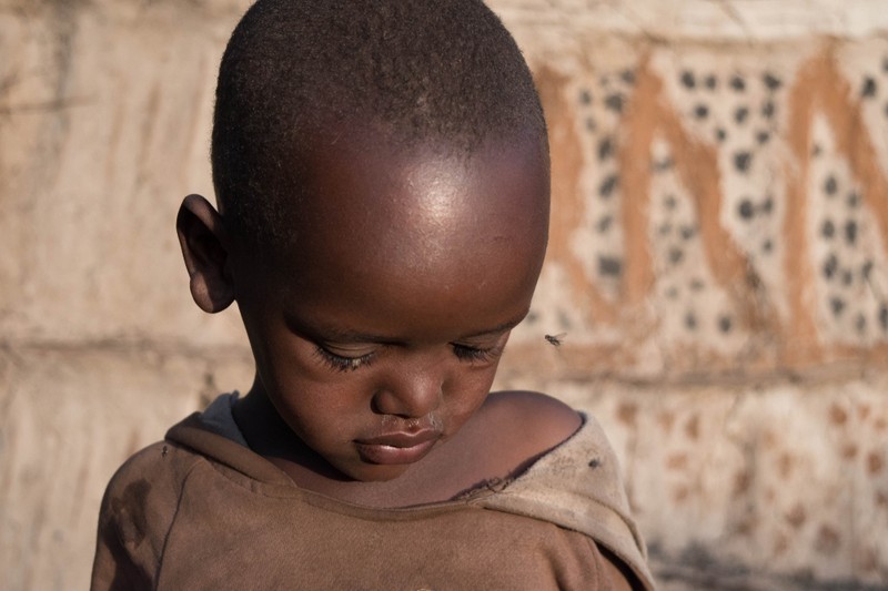 Álomkór: ezek a tünetei