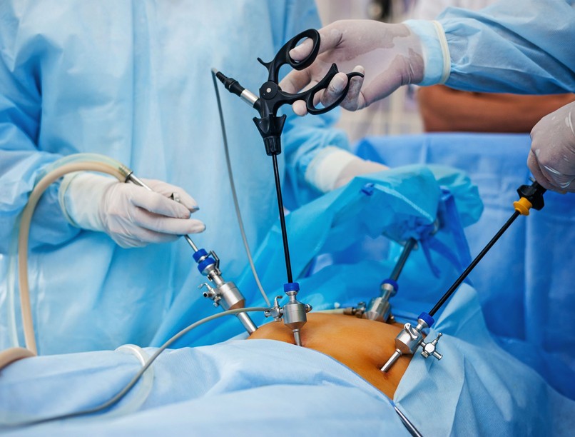 Hogy zajlik egy sérvműtétnél az egynapos eljárás