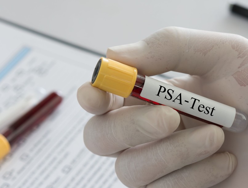 férfiegészség-kampány prosztatarák ellen