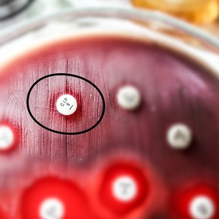 Elkeserítő eredmények: a jövő antibiotikumai hatástalanok lesznek a baktériumokkal szemben című cikk nyitóképe