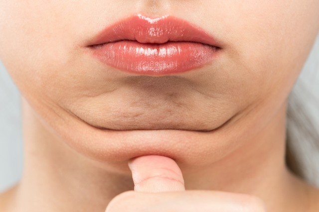 Mitől alakul ki a toka? Így lehet újra szép a nyakkontúrja