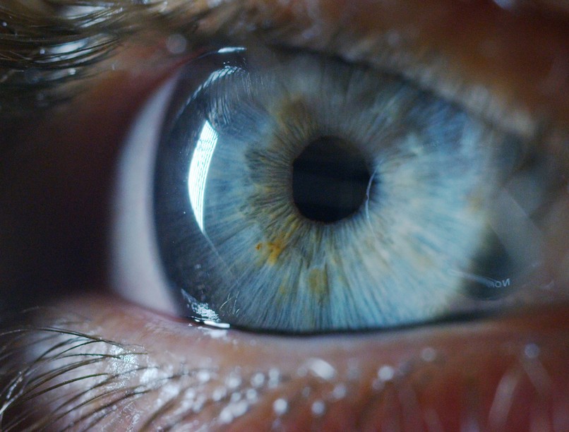 elváltozás szem zsíranyagcsere-zavar cukorbetegség tünete