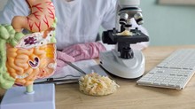 Hogyan változtathatja meg a cukor elhagyása a bélmikrobiomot? Nem lett jó vége, drámai eredmények születtek! című cikk nyitóképe