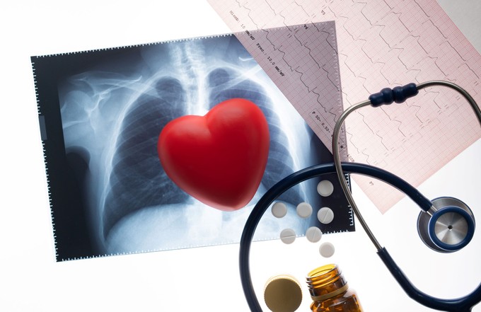 Béta-blokkolók: egy idő után abba lehet hagyni? A kutatók szerint ennyi kezelési idő is elegendő lehet szívroham után című cikk nyitóképe