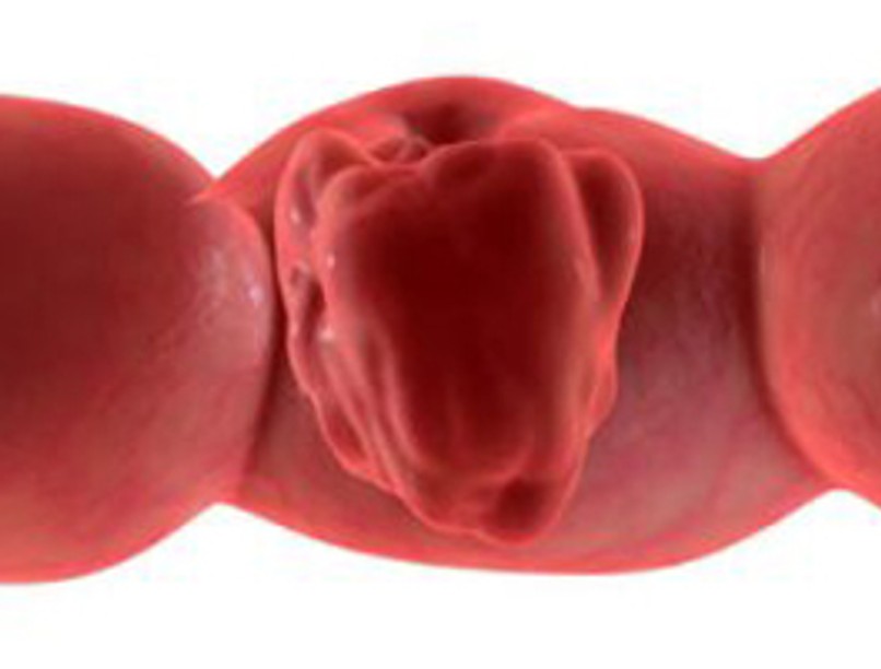 vastagbelrak-piros-280x200-d00000437ce4a95213e2a