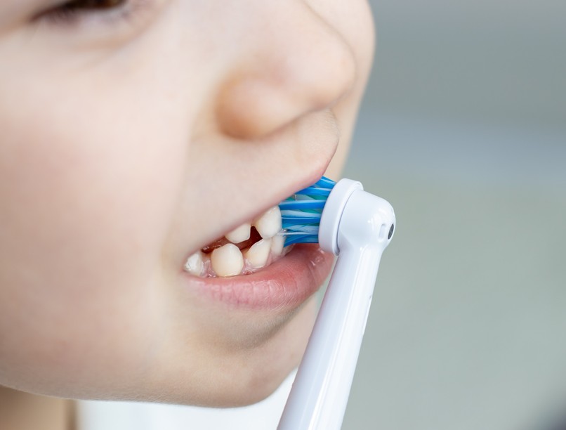 fogmosás gyerek szájhigiénia, fogápolás