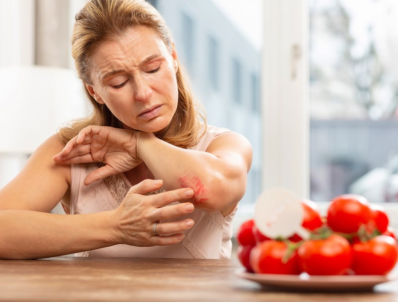 allergia ételallergia allergiás kiütések