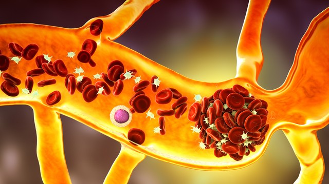 Ha ezt a 3 tünetet egyszerre érzi, ne halogasson, rögtön hívjon mentőt!
