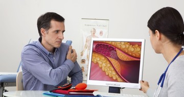  Sokan nem veszik komolyan: ezek a jelek árulkodhatnak arról, hogy az artériái beszűkültek 