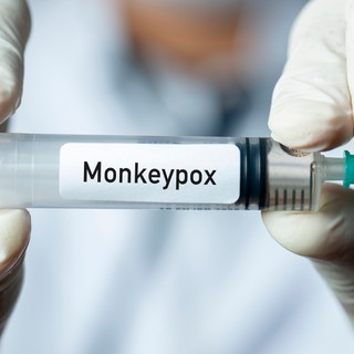 Imvanex : ezt a vakcinát szerzi be az EU a majomhimlő ellen című cikk nyitóképe