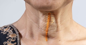Lenyeltem egy szálkát, utána meddig normális a torokban a kaparó érzés? Az orvos válaszol     