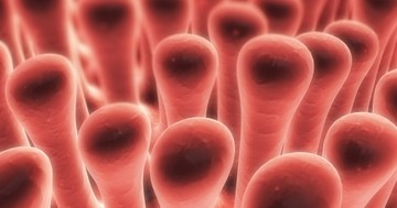  Így derítheti ki, hogy elsorvadtak-e a bélbolyhai 