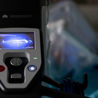 Semmelweis Egyetem: mostantól robottechnikával is műtenek nőgyógyászati daganatokat című cikk nyitóképe
