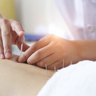 Mire jó az akupunktúra? című cikk nyitóképe