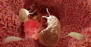 Mit okoz a Helicobacter pylori baktérium és mit tehetünk ellene?