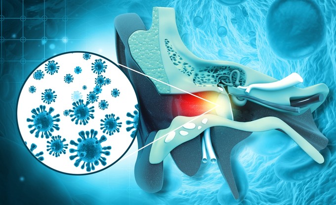 Fülfájás strandolás után - mikor forduljak orvoshoz? Ezt tanácsolja  a Semmelweis docense című cikk nyitóképe