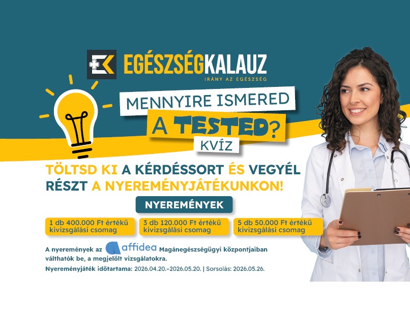 Mennyire ismered a tested nyeremény játék kvíz
