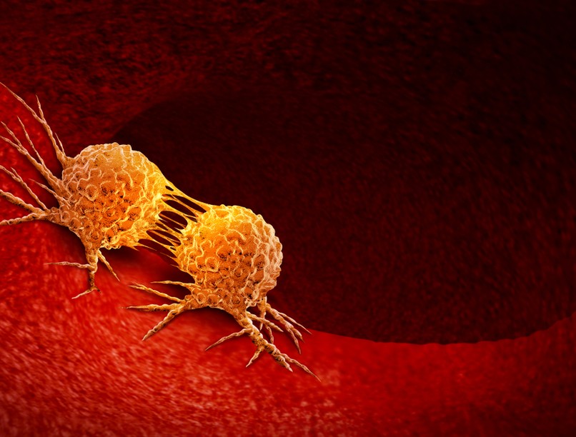 rezisztens keményítő, zöld banán, rákos megbetegdés, daganatos betegségek, bélrák, kutatás