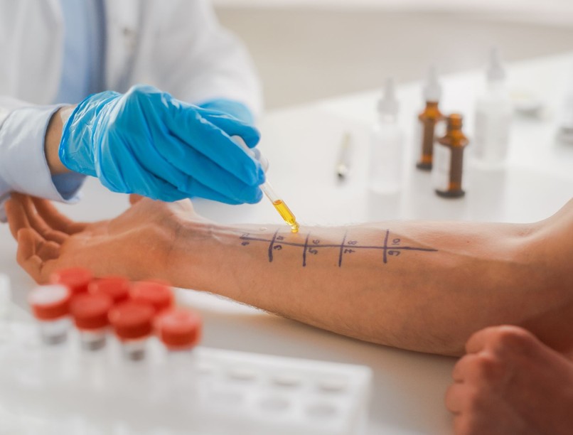 Allergiavizsgálat hogy végzik