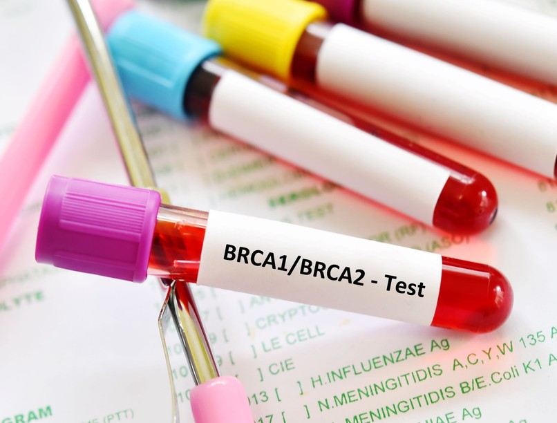 vérvétel BRCA teszt vizsgálat mellrák petefészekrák