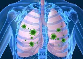 A súlyos pneumococcus fertőzésről és megelőzéséről