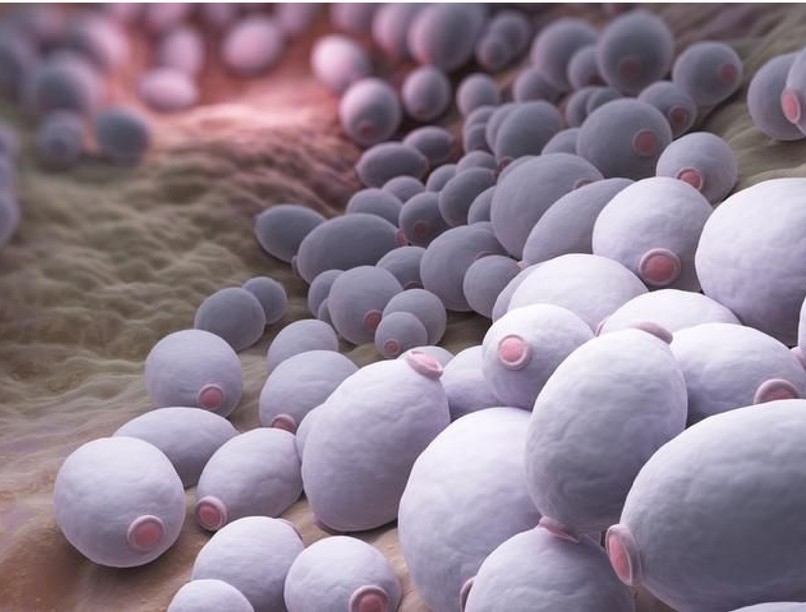 candida gomba, tünetei, candidiásis, szájpenész, cukorbetegség