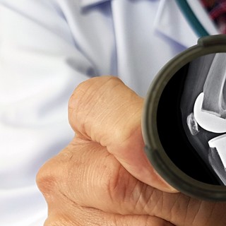 Mennyi ideig tart a felépülni csípő- és térdprotézis beültet��s után? című cikk nyitóképe